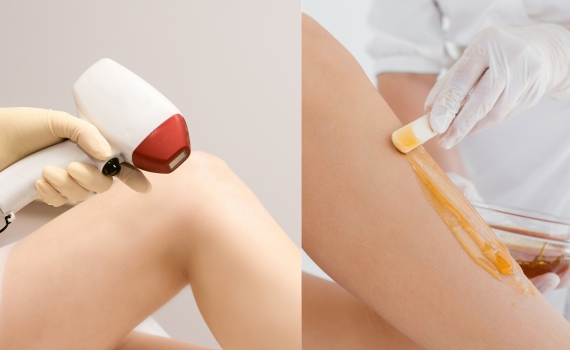 ipl waxing